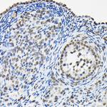 hnRNP A3 Antibody in Immunohistochemistry (Paraffin) (IHC (P))