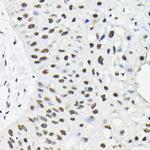 hnRNP A3 Antibody in Immunohistochemistry (Paraffin) (IHC (P))