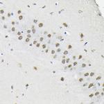 hnRNP A3 Antibody in Immunohistochemistry (Paraffin) (IHC (P))