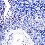 CD137 (4-1BB) Antibody in Immunohistochemistry (Paraffin) (IHC (P))