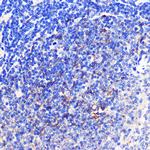 CD137 (4-1BB) Antibody in Immunohistochemistry (Paraffin) (IHC (P))