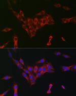 EIF4A1/EIF4A2/EIF4A3 Antibody in Immunocytochemistry (ICC/IF)