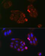 EIF4A1/EIF4A2/EIF4A3 Antibody in Immunocytochemistry (ICC/IF)