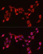 EXT1 Antibody in Immunocytochemistry (ICC/IF)