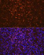 NGAL Antibody in Immunocytochemistry (ICC/IF)