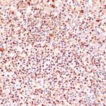 ALOX5 Antibody in Immunohistochemistry (Paraffin) (IHC (P))