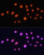 GCN5 Antibody in Immunocytochemistry (ICC/IF)