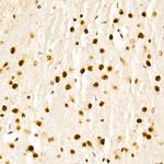 GCN5 Antibody in Immunohistochemistry (Paraffin) (IHC (P))