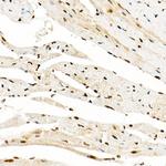 GCN5 Antibody in Immunohistochemistry (Paraffin) (IHC (P))