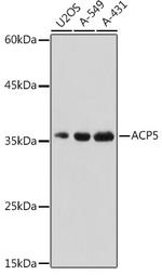 Tartrate Resistant Acid Phosphatase Antibody in Western Blot (WB)