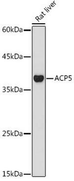 Tartrate Resistant Acid Phosphatase Antibody in Western Blot (WB)