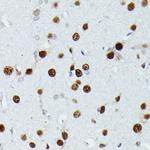 MEF2C Antibody in Immunohistochemistry (Paraffin) (IHC (P))