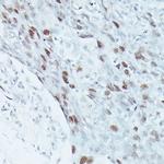 MEF2C Antibody in Immunohistochemistry (Paraffin) (IHC (P))