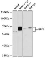 GRK1 Antibody in Western Blot (WB)