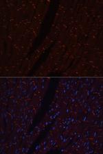 N-cadherin Antibody in Immunohistochemistry (Paraffin) (IHC (P))