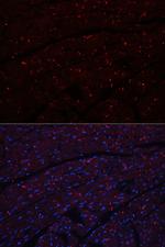 N-cadherin Antibody in Immunohistochemistry (Paraffin) (IHC (P))