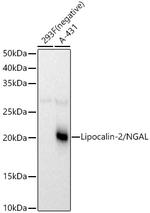 NGAL Antibody in Western Blot (WB)