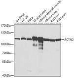 alpha Actinin 2 Antibody in Western Blot (WB)