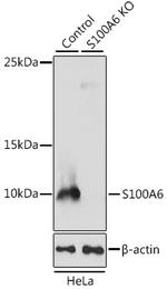 S100A6 Antibody in Western Blot (WB)