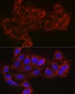 eIF4E2 Antibody in Immunocytochemistry (ICC/IF)