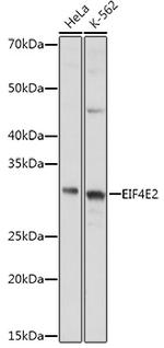 eIF4E2 Antibody in Western Blot (WB)