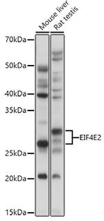 eIF4E2 Antibody in Western Blot (WB)