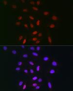 TDP1 Antibody in Immunocytochemistry (ICC/IF)