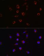 APLP2 Antibody in Immunocytochemistry (ICC/IF)