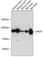 APLP2 Antibody in Western Blot (WB)