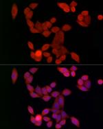 UBE2C Antibody in Immunocytochemistry (ICC/IF)