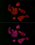 UBE2C Antibody in Immunocytochemistry (ICC/IF)