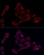 UBE2C Antibody in Immunocytochemistry (ICC/IF)