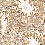 UBE2C Antibody in Immunohistochemistry (Paraffin) (IHC (P))