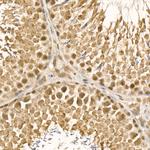 UBE2C Antibody in Immunohistochemistry (Paraffin) (IHC (P))