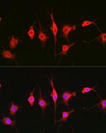 HPa1 Antibody in Immunocytochemistry (ICC/IF)