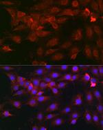 HPa1 Antibody in Immunocytochemistry (ICC/IF)