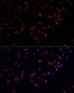 MATR3 Antibody in Immunocytochemistry (ICC/IF)