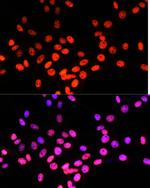 MATR3 Antibody in Immunocytochemistry (ICC/IF)