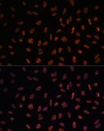 MATR3 Antibody in Immunocytochemistry (ICC/IF)