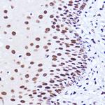 MATR3 Antibody in Immunohistochemistry (Paraffin) (IHC (P))