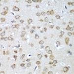 eIF1AX Antibody in Immunohistochemistry (Paraffin) (IHC (P))