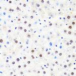 POLR2B Antibody in Immunohistochemistry (Paraffin) (IHC (P))