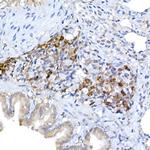 KMT2E Antibody in Immunohistochemistry (Paraffin) (IHC (P))