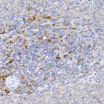 KMT2E Antibody in Immunohistochemistry (Paraffin) (IHC (P))