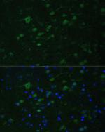 KMT2E Antibody in Immunohistochemistry (Paraffin) (IHC (P))