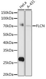 Folliculin Antibody in Western Blot (WB)