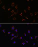 NFS1 Antibody in Immunocytochemistry (ICC/IF)