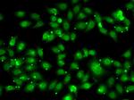 TR2 Antibody in Immunocytochemistry (ICC/IF)