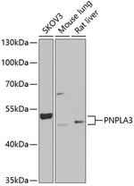 PNPLA3 Antibody in Western Blot (WB)