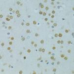 MUS81 Antibody in Immunohistochemistry (Paraffin) (IHC (P))